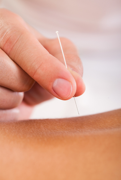 medical acupuncture